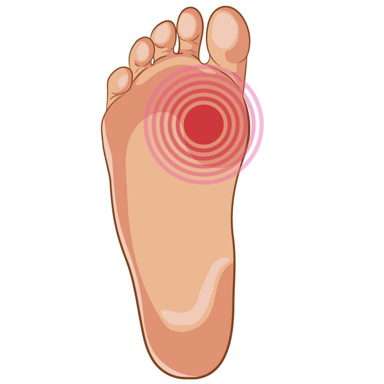 Illustration of foot with red spot